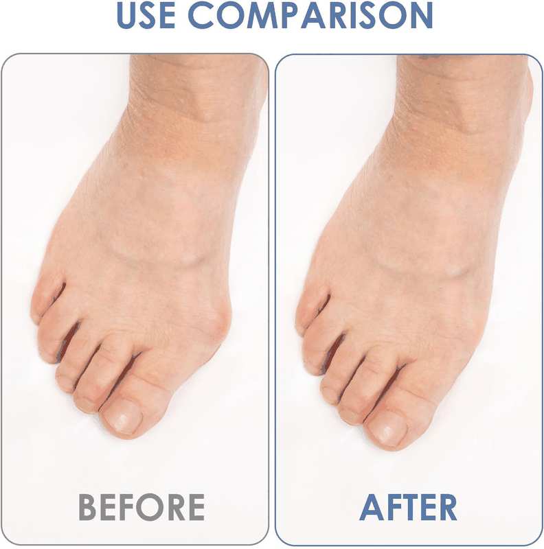 2 Pairs Silicone Toe Separators, Feet Gel Spacers to Correct Bunions and Restore Toes, Yoga Training Therapeutic Relief Pain Hammer & Claw Toe Flamingo Feet Corrector for Women & Men (Black) image number 4