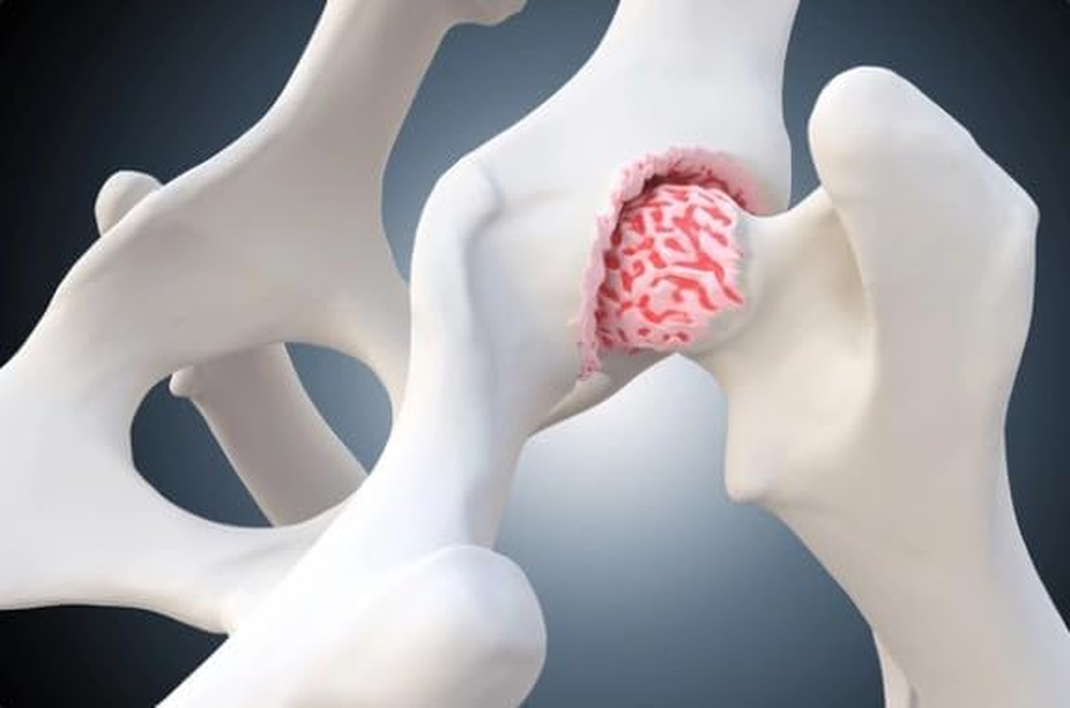 Canine Jointease MSM Chondroitin Glucosamine Powder Dog Joint Arthritis Dysplasia (400Gm) image number 2