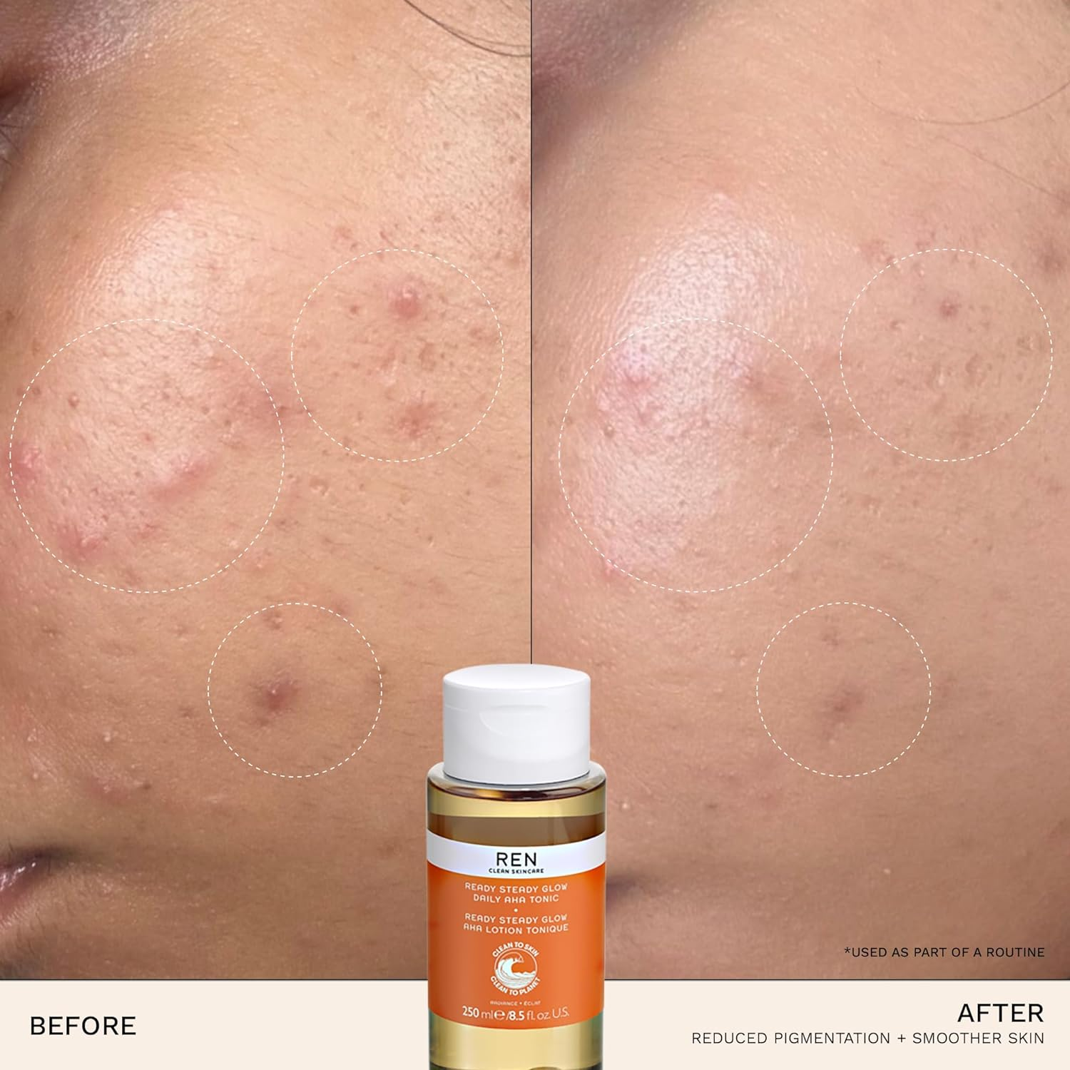 REN Ready Steady Glow Daily AHA Tonic by REN for Women - 8.5 Oz Toner, 251.38 Millilitre