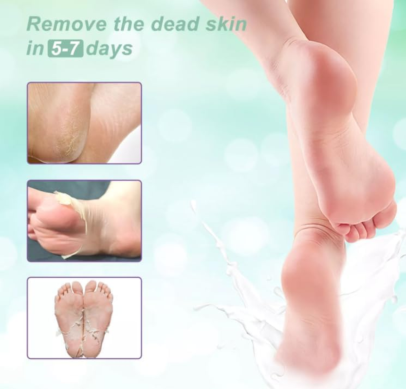 Pedi Bliss Foot Peel Mask 2 Pack - Exfoliating Peeling Away Calluses and Dead Skin Cells for Men & Women - Moisturizing - Remove Dead Skin,Calluses & Cracked Heels (Natural Rose) image number 1