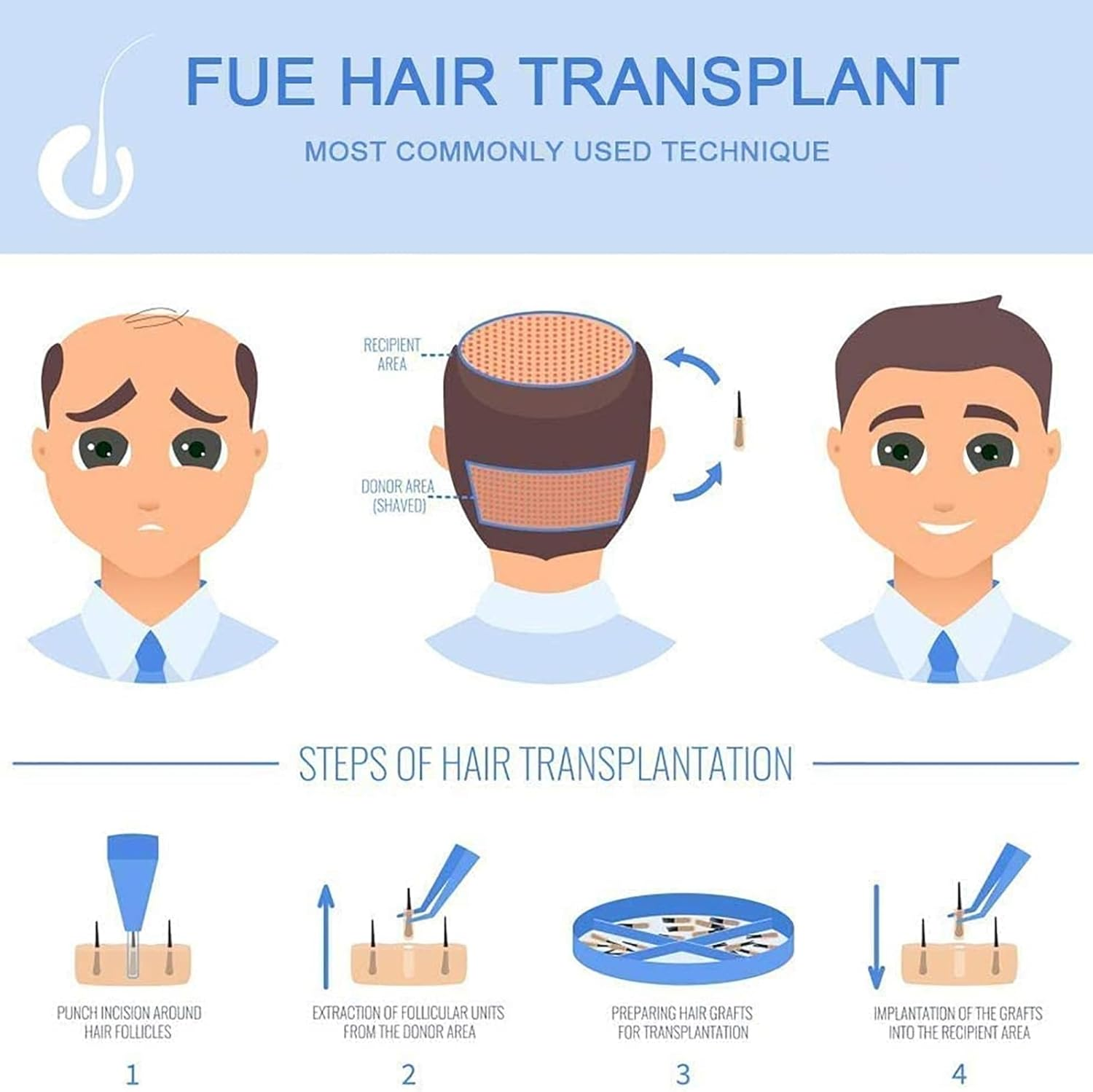 Hair Follicle Extractor, Hair Transplant Treatment Growth System with 0.8/0.9/1Mm Hair Transplant Size, 0-20000Rpm Stepless Speed Regulation, Safe without Scars, for Ease Helps Hair Loss