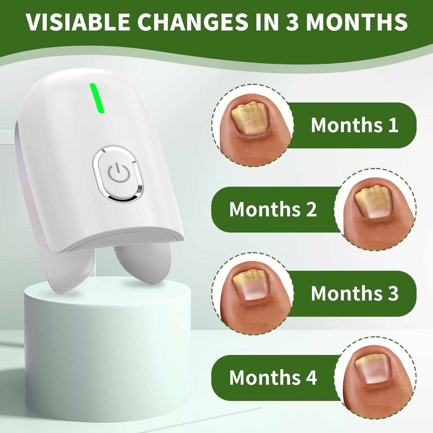 Nail Fungus Laser Treatment Device, Toenail Finger Nail Fungus Treatment with 470Nm Blue Light 660Nm Red Light and 905Nm Infrared Light, Natural Nail Fungus Cleaning Solution for Home Use