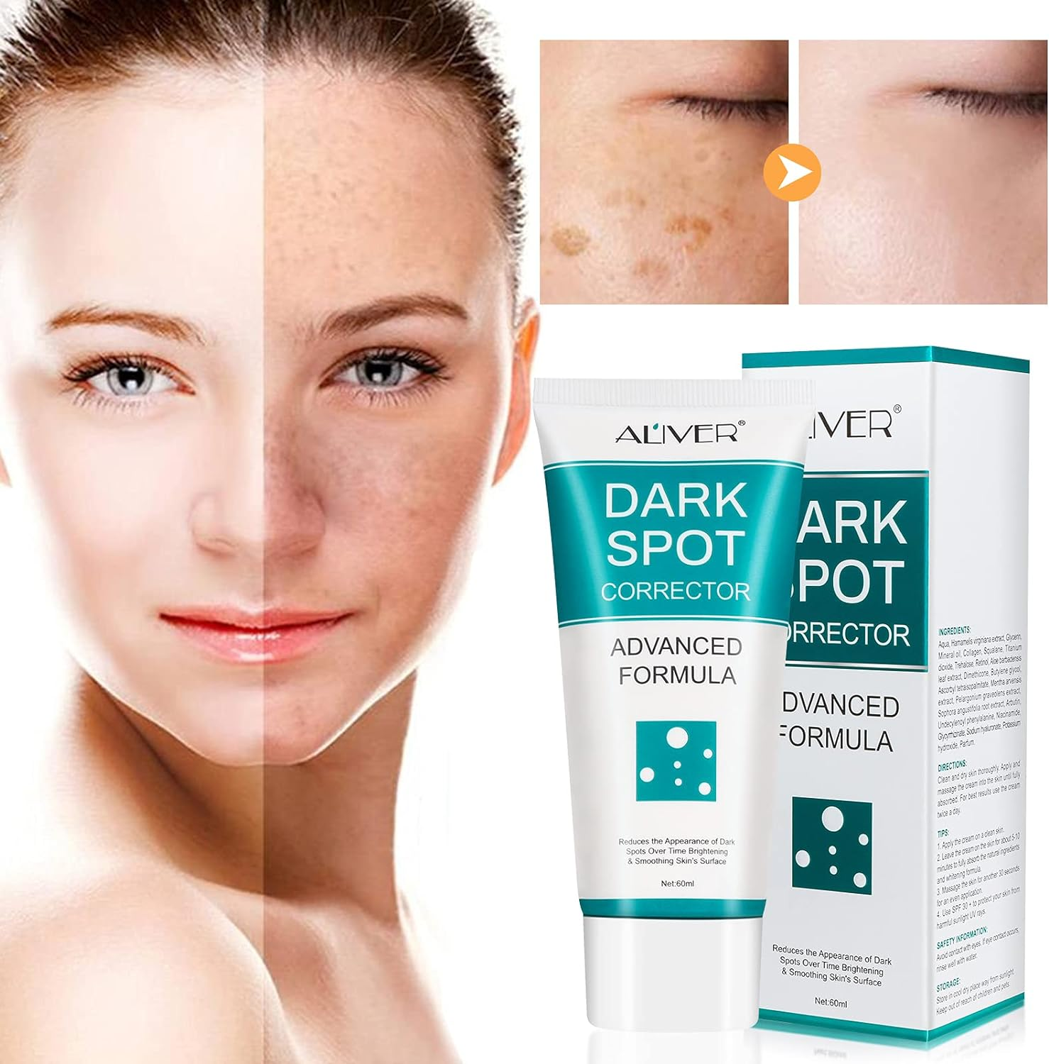 Dark Spot Corrector, Dark Spot Remover for Face and Body, Freckle Remover Cream, Age Spot Remover for Face for Women Men, Evens and Fades Spots with Effective Formula, Suitable for Men and Women