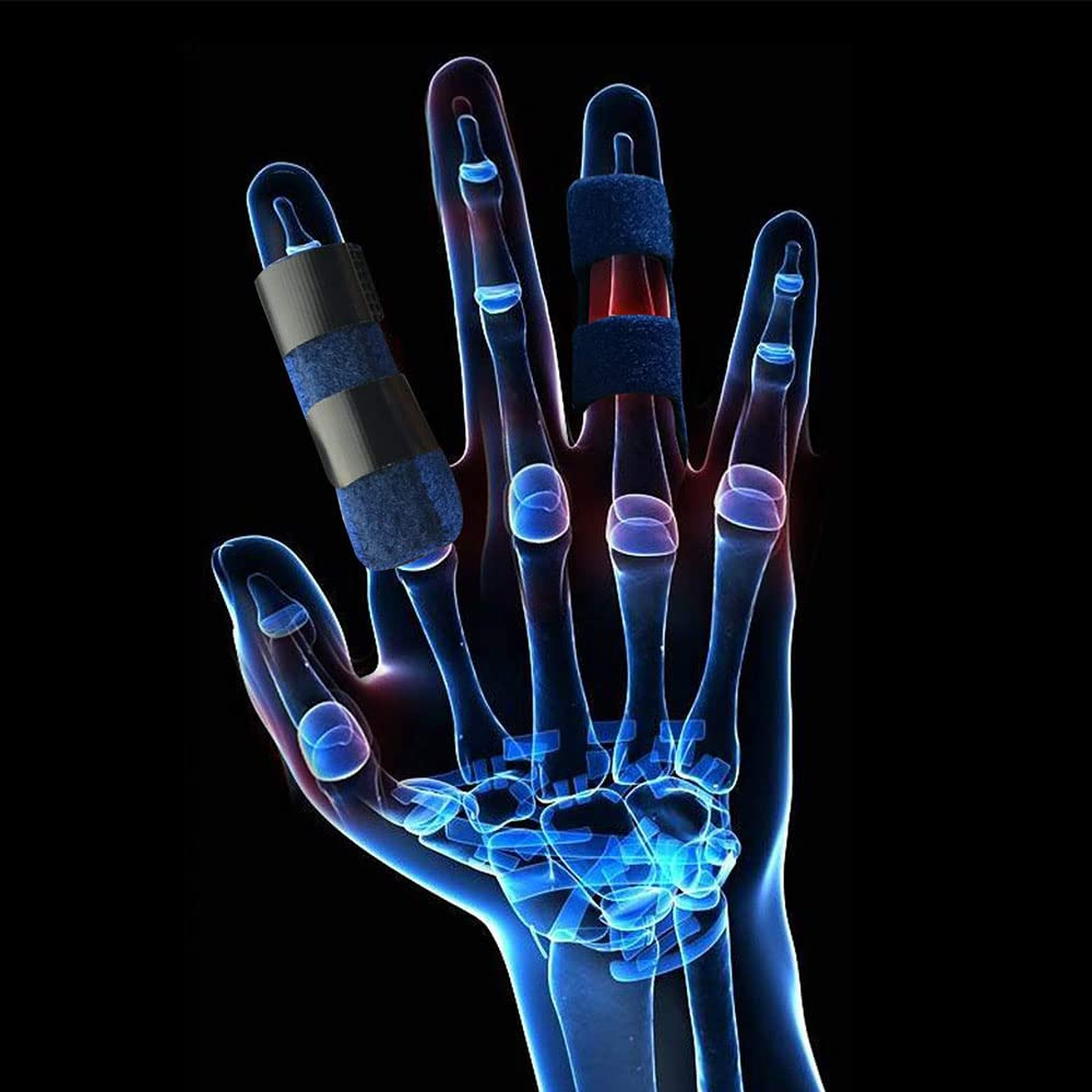 Finger Splint Brace Fracture Trigger Fingers Protector Pain Relief Adjustable AU image number 6