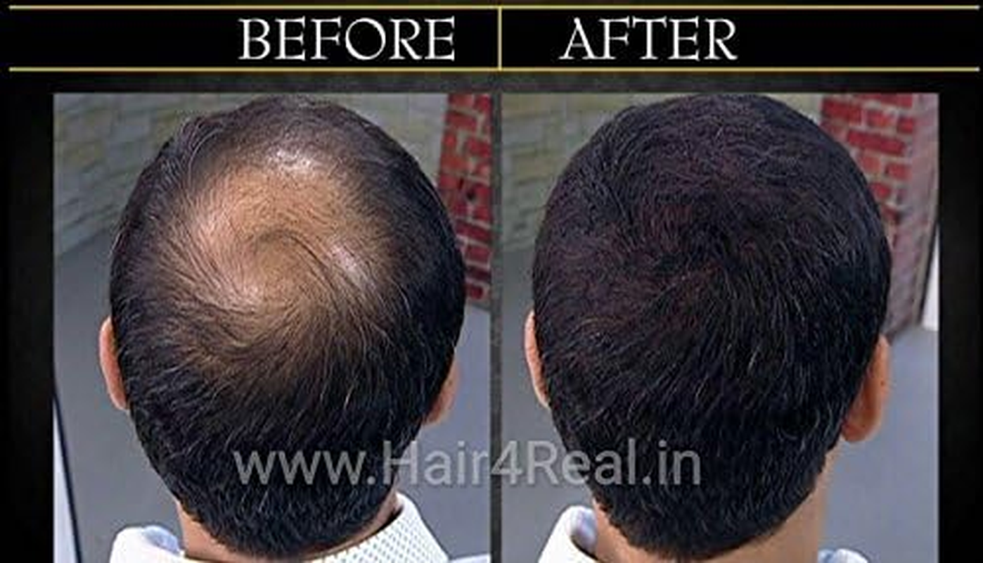 12Gx2 (Total 24G) Black Hair Thickening Fibers with Locking Spray 30Ml (Pack of 3) image number 2