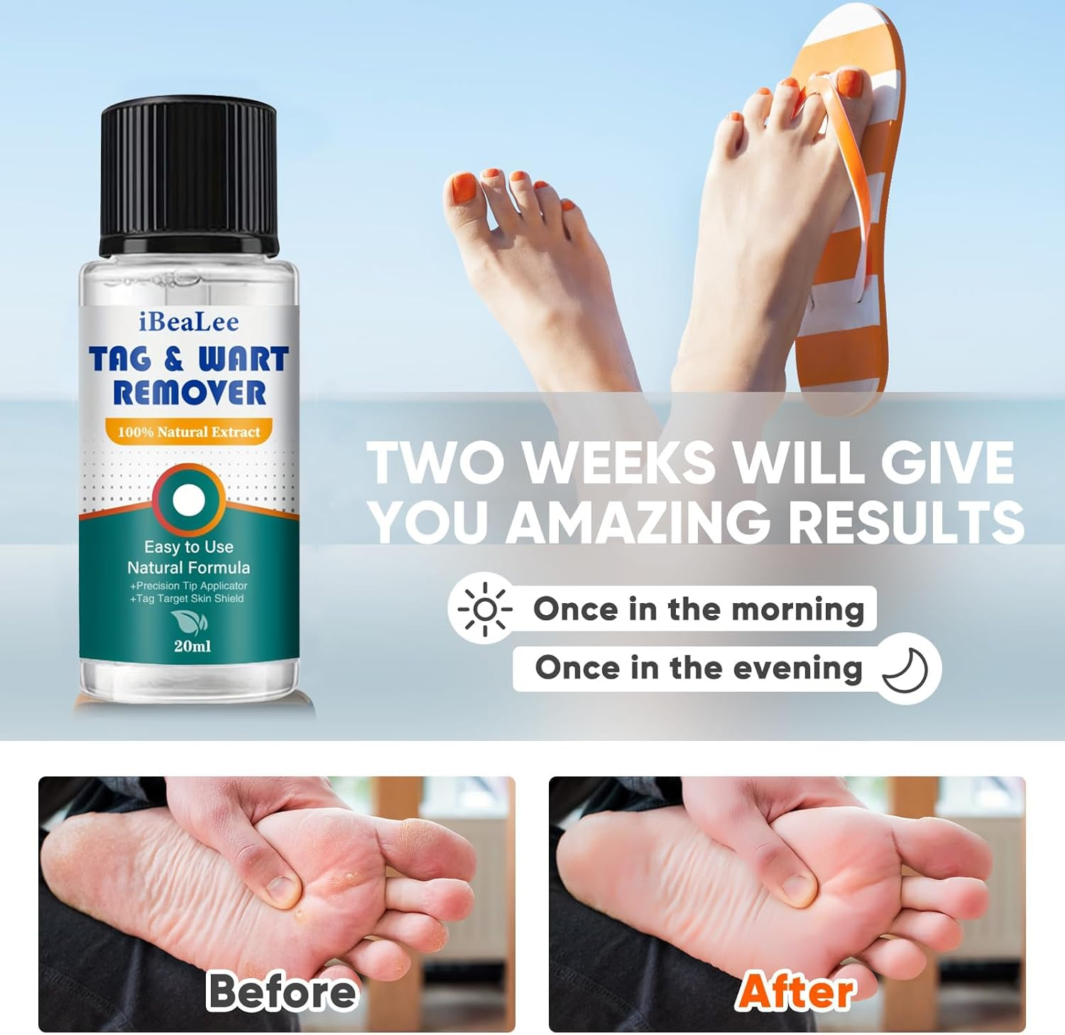 Skin Tag Remover,Wart Remover,Fliquid Wart Gel with Salicylic Acid - Fast Acting, Designed for Warts, Plantar Warts, Genital Warts, Common Warts, Flat Warts, Corns,Calluses image number 2