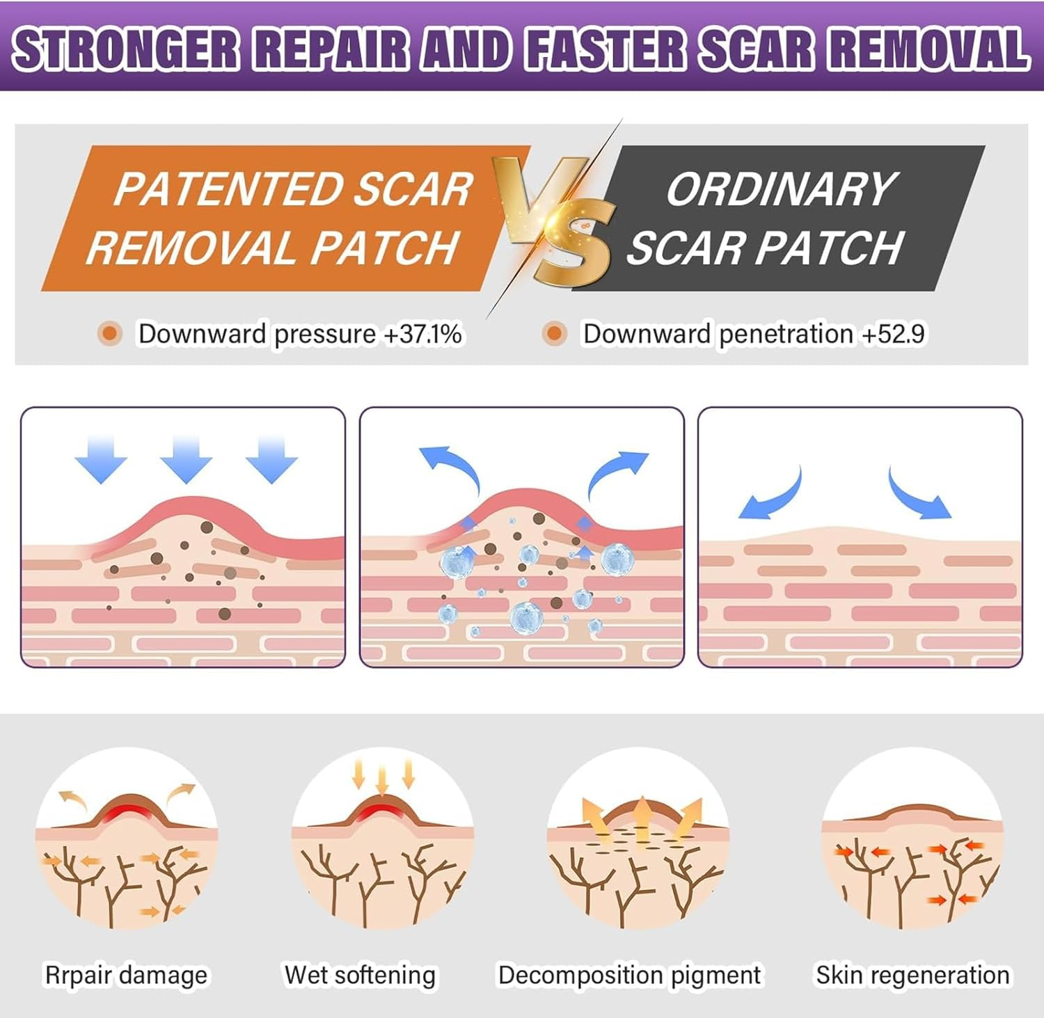 Silicone Scar Sheets, Silicone Scar Tape Strips(4X150Cm), Professional Away Sheets for Surgical Scars, Keloid, C-Section, Burn Et