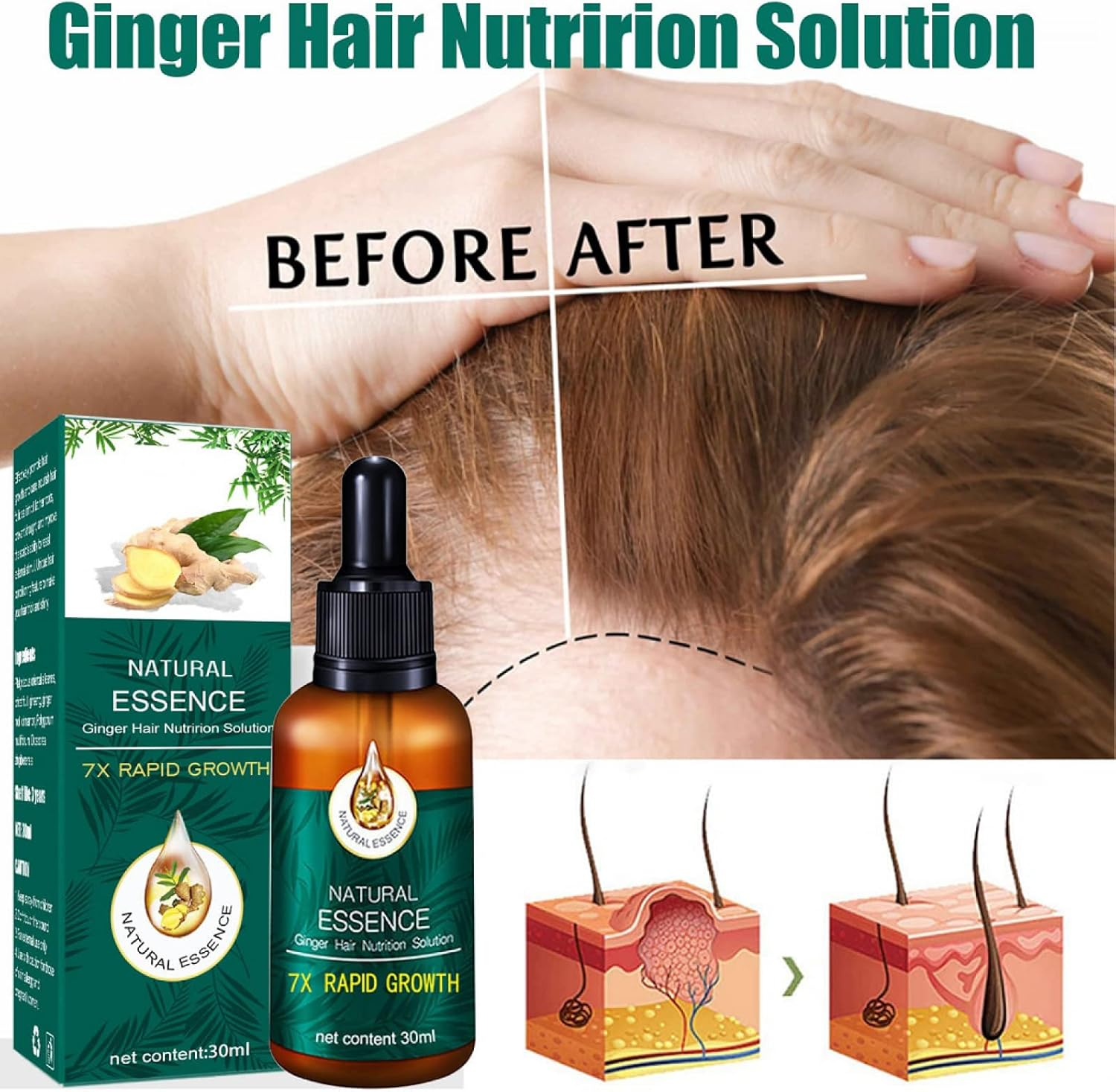 7X Rapid Hairup Serum, Ginger Hair Growth Serum, Rapid Growth Hair Treatment 7 Day Hair Growth Serum Essence Oil Regrow, for Fuller Healthier Hair, Prevent Hair Loss and Thinn-30Ml image number 5