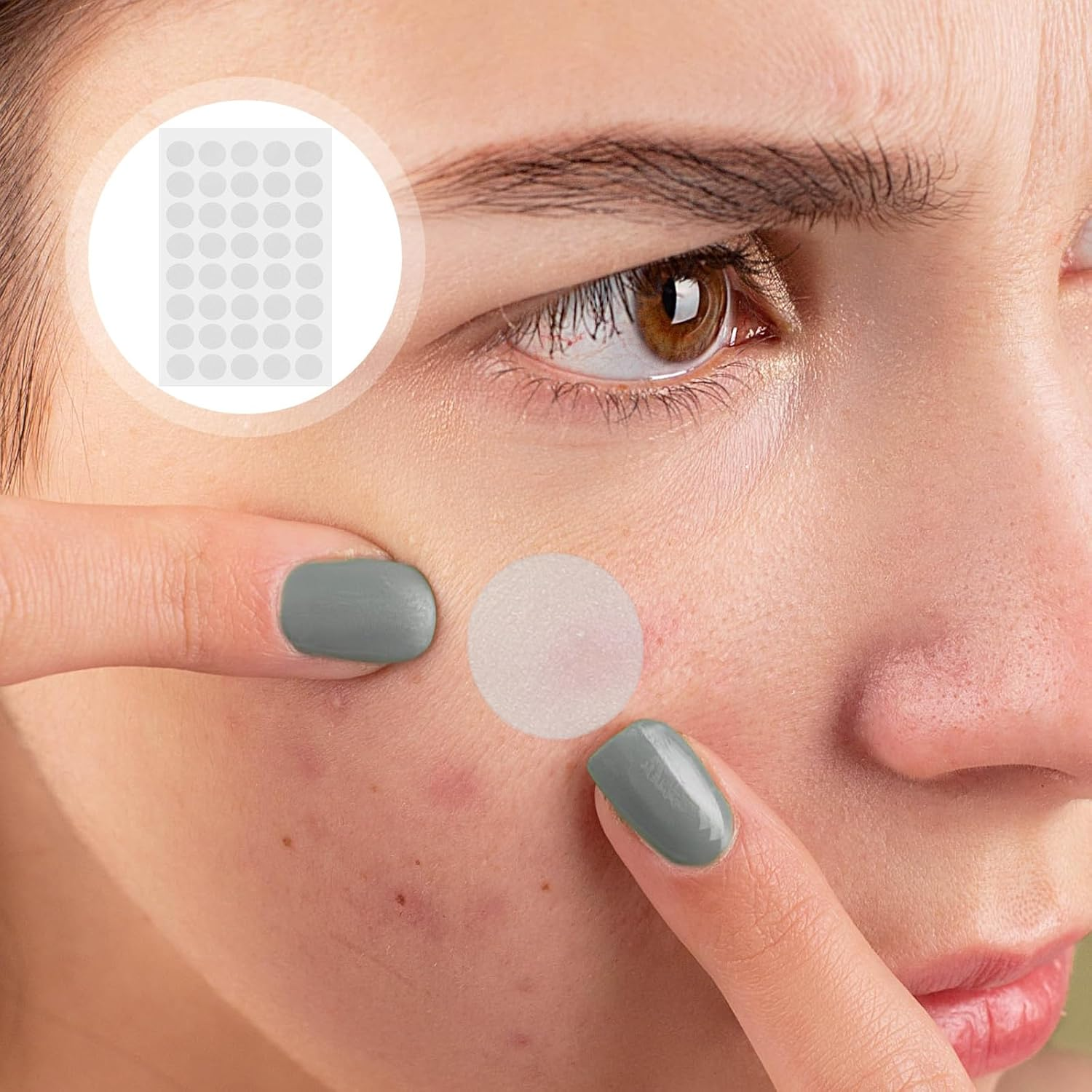 480 Pcs Mole Patch Stickers Labels Remover Patch Mole Remove Patch Wart Skin Patches Face Patches Facial Mole Patches Skin Patches Accessories Glue Peeled image number 2