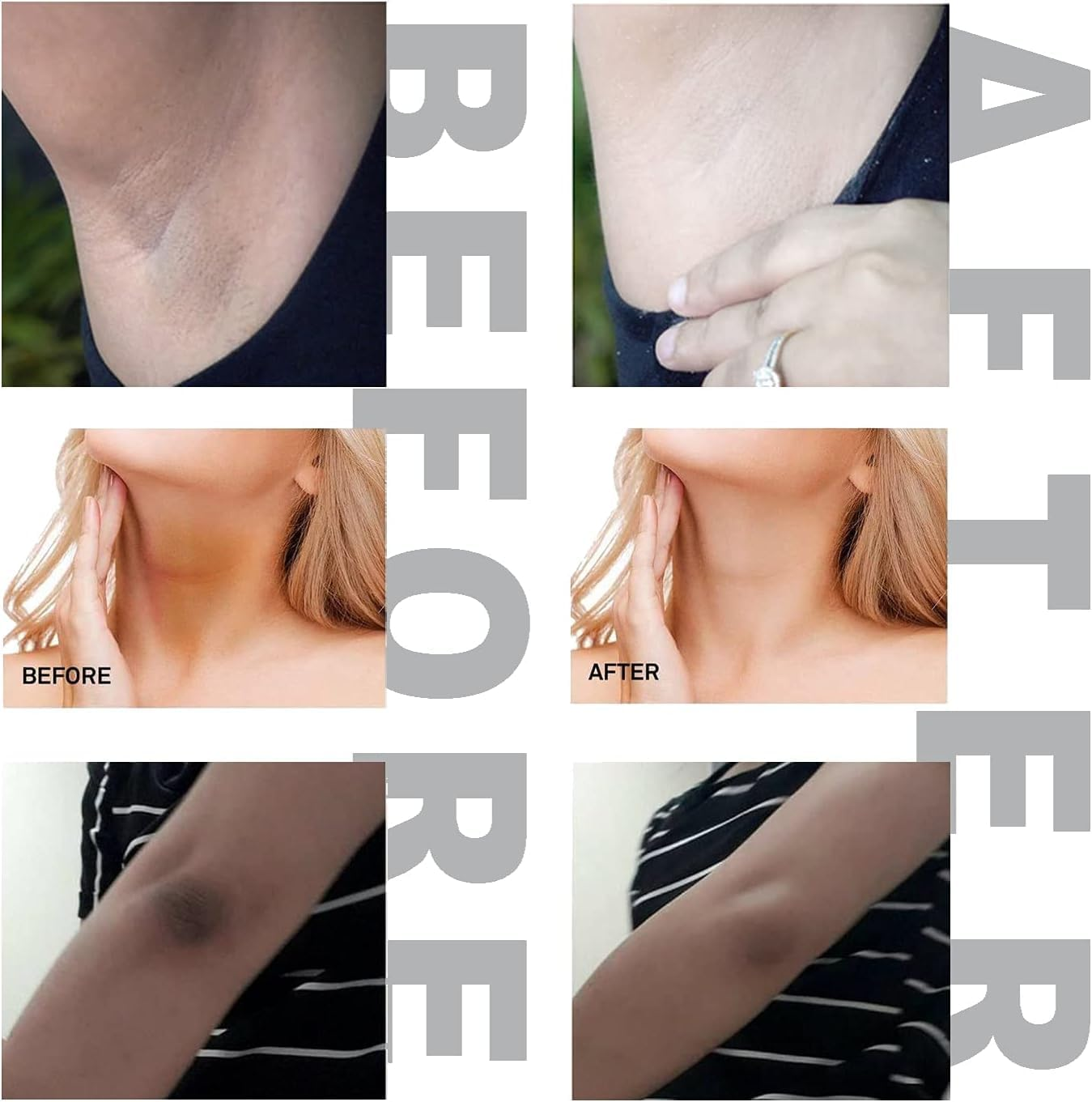 Moon-Shadow Dark Spot Remover Cream for Face, Body & Intimate Areas - Hyperpigmentation & Even Skin Tone - Suitable for All Skin Types (1.7Oz/50Ml) image number 1