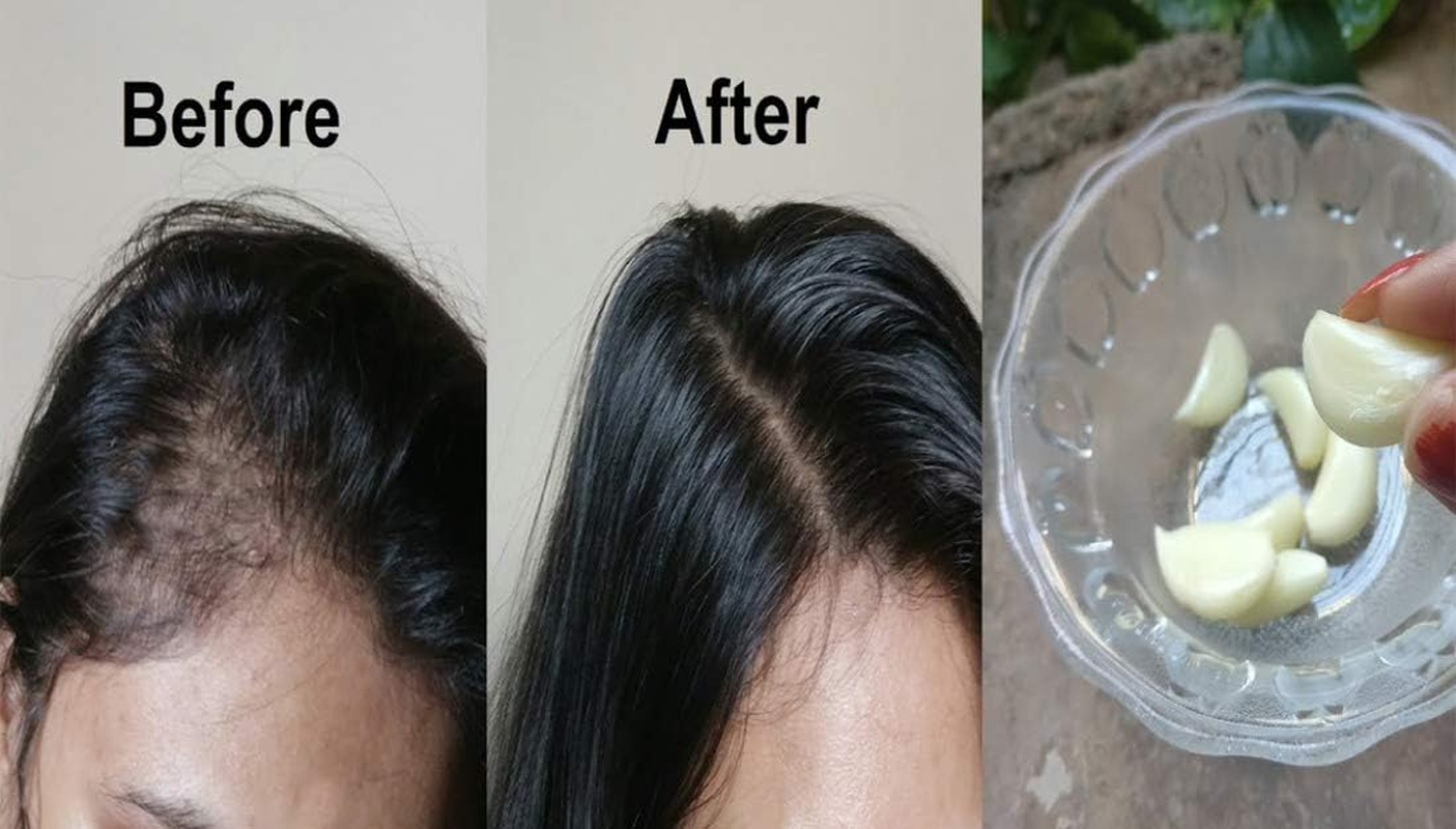 Dominaro 100 % Pure & Natural Hibiscus Oil & Garlic Oil (Combo Pack of 2 Bottle ) 200 Ml Hair Oil (200 Ml) image number 2