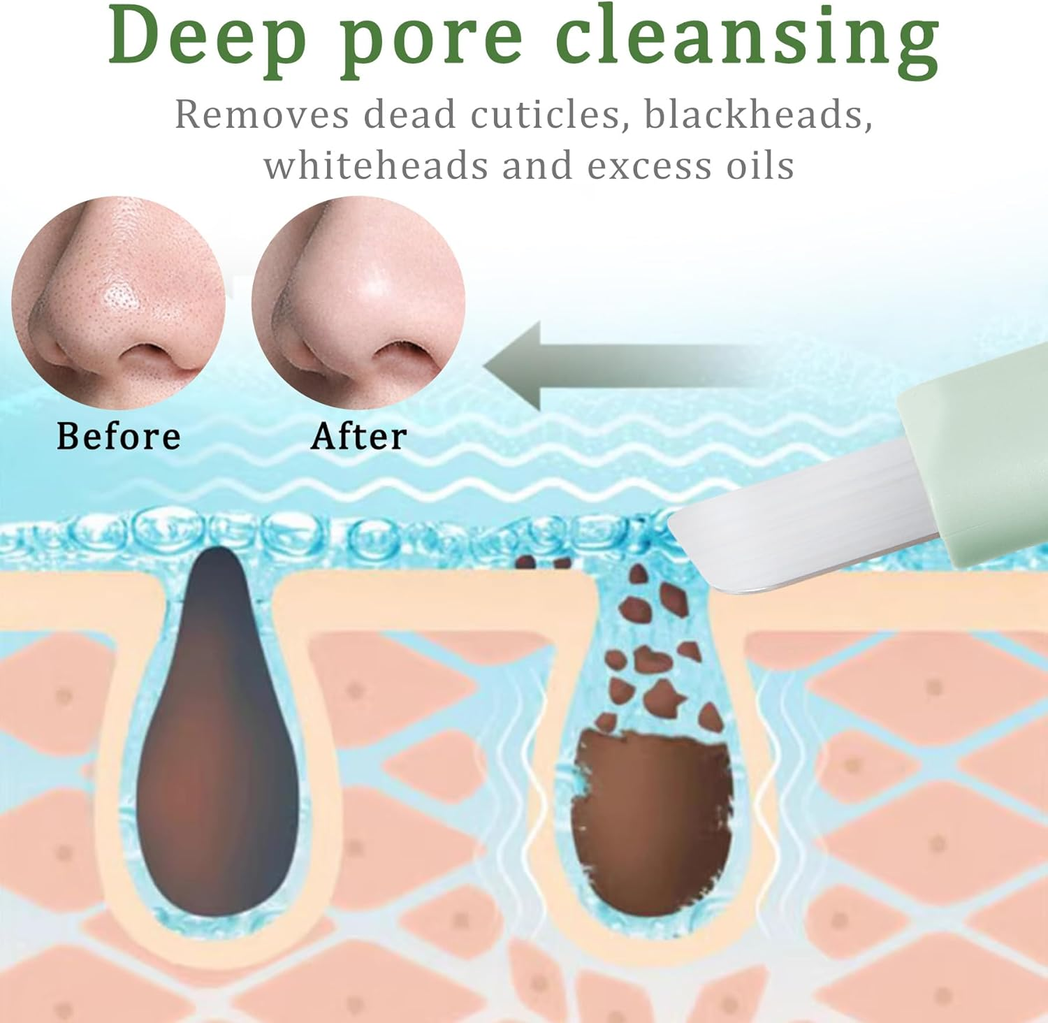 Blackhead Remover Tools - Nose Scraper for Blackheads Pore Clean Scraper Facial Deep Cleansing Tool,Safe & Made from Silicon image number 1