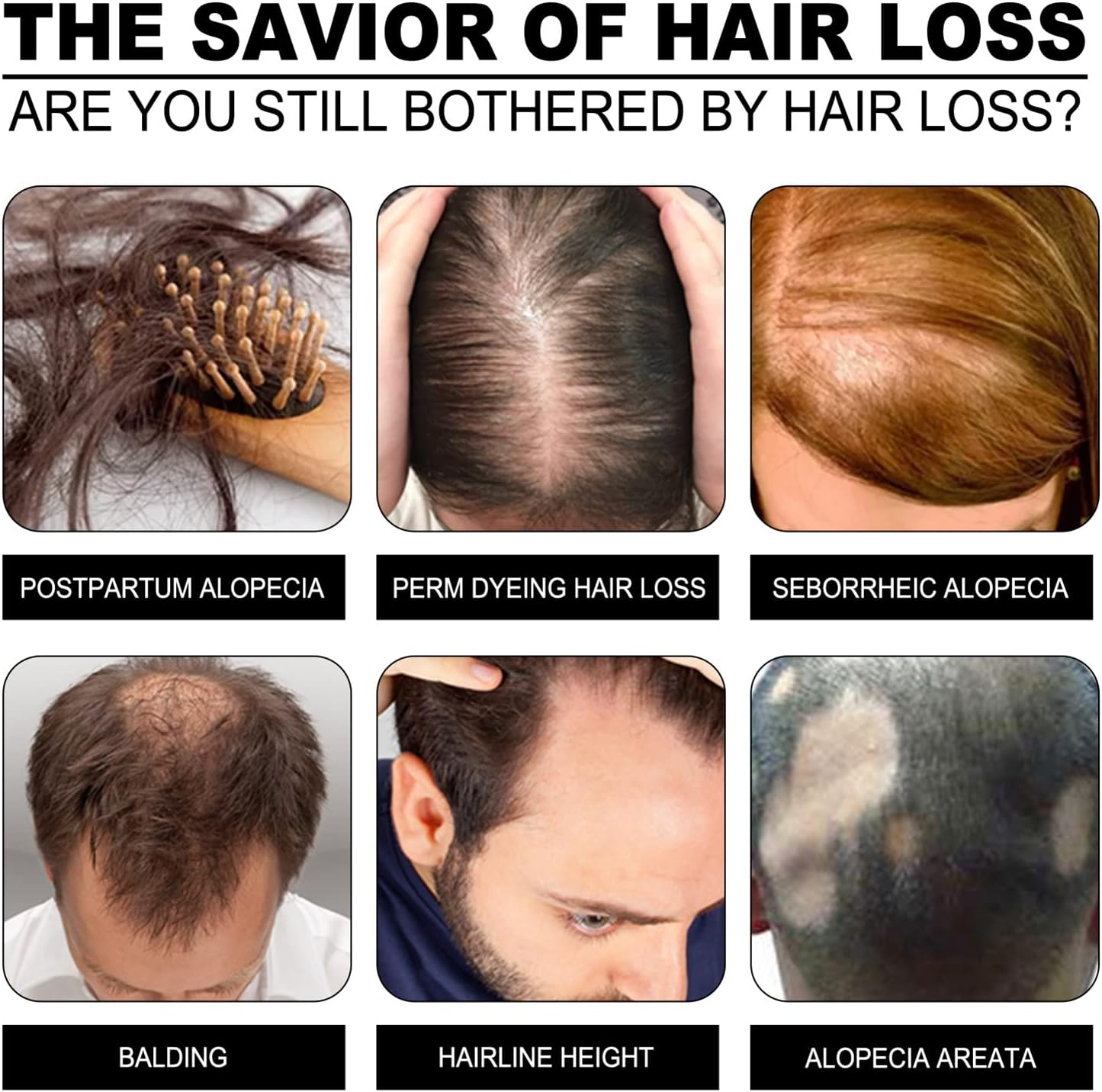 1Pc Hair Growth Rice Soap Shampoo Bar Nourish Hair Root Balance Oily Scalp Increase Hair Volume image number 6