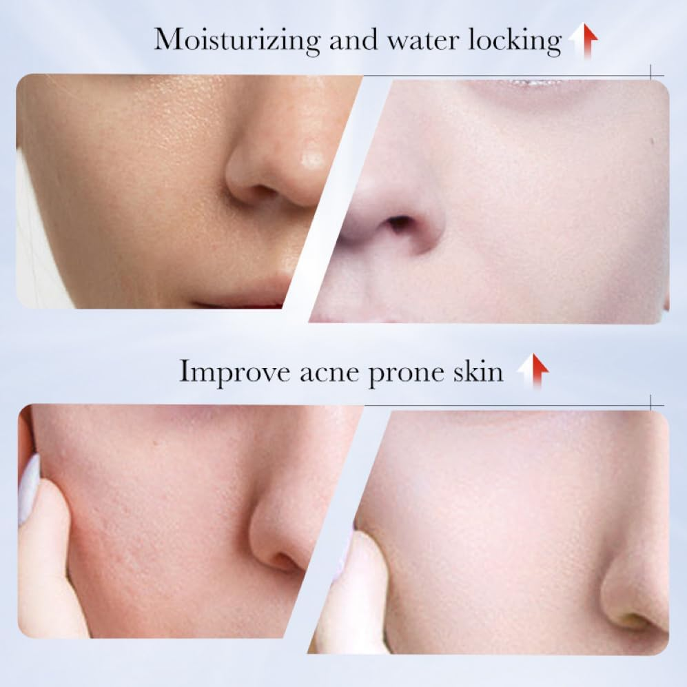 Kojic Acid Cream - 1.7 Fl Oz / 50 Ml - Skin Brightening Cream for Face, Body, Hands - with Glycolic Acid (Red) image number 5