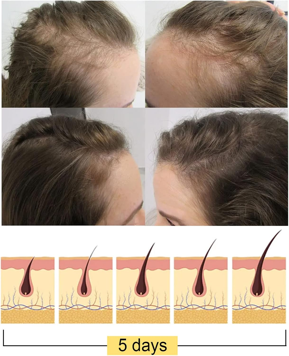 1Pc Hair Growth Rice Soap Shampoo Bar Nourish Hair Root Balance Oily Scalp Increase Hair Volume image number 3