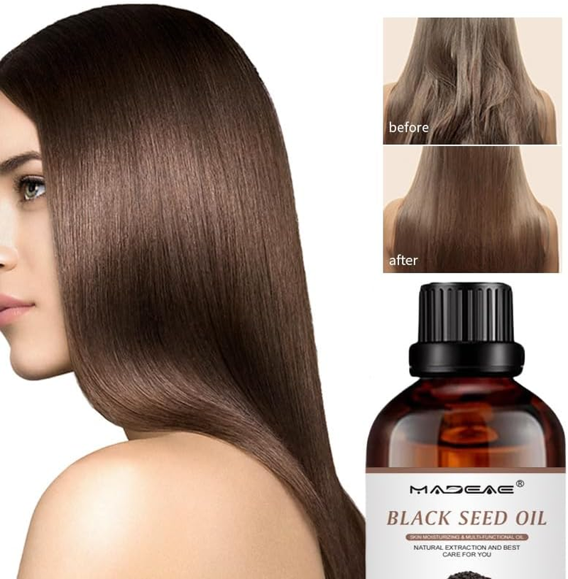 Organic Black Seed Oil for Face and Skin, Cold Pressed, Pure, USDA Certified, 100Ml