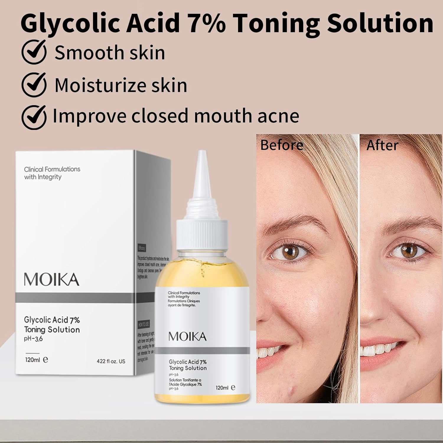 Hydrating Glycolic Acid Toner 7% &ndash; Exfoliating Face Serum for Smooth & Glowing Skin, Gentle Moisturizing Toner for Women & Men (120Ml) image number 1