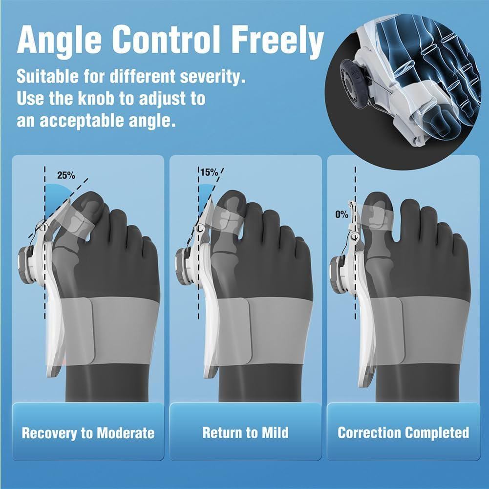 Adjustable Knob Bunion Splint Bunion Corrector for Women Hallux Valgus Brace Splint Pads Bunion Big Toe Separators Straightener for Women & Men(1-Pcs)