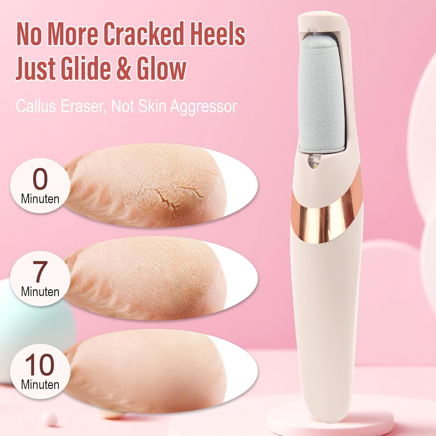 Electric Callus Remover, Callus Removal Foot, Electric Callus Remover, Electric Callus Remover Feet, Electric Callus Remover Electric Batteries image number 3