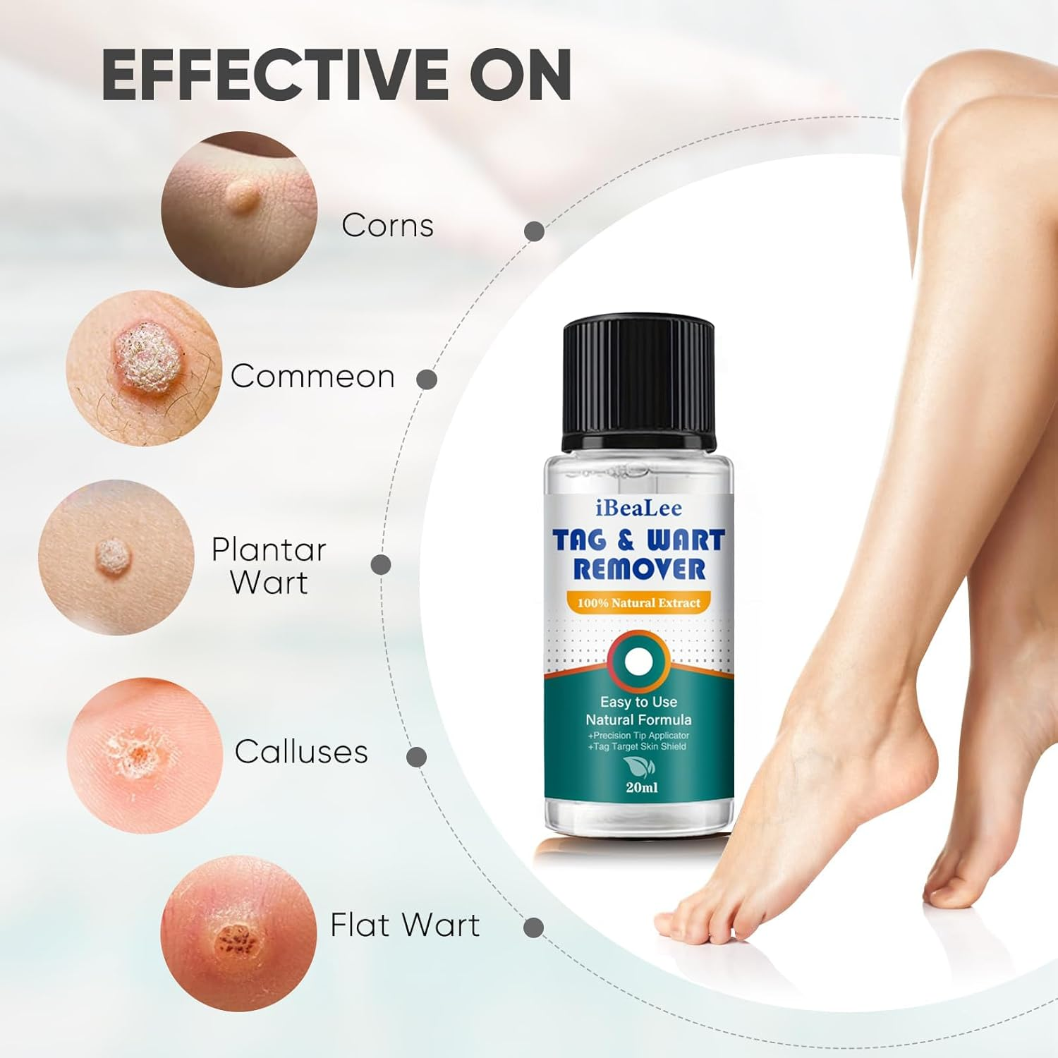 Skin Tag Remover,Wart Remover,Fliquid Wart Gel with Salicylic Acid - Fast Acting, Designed for Warts, Plantar Warts, Genital Warts, Common Warts, Flat Warts, Corns,Calluses image number 1