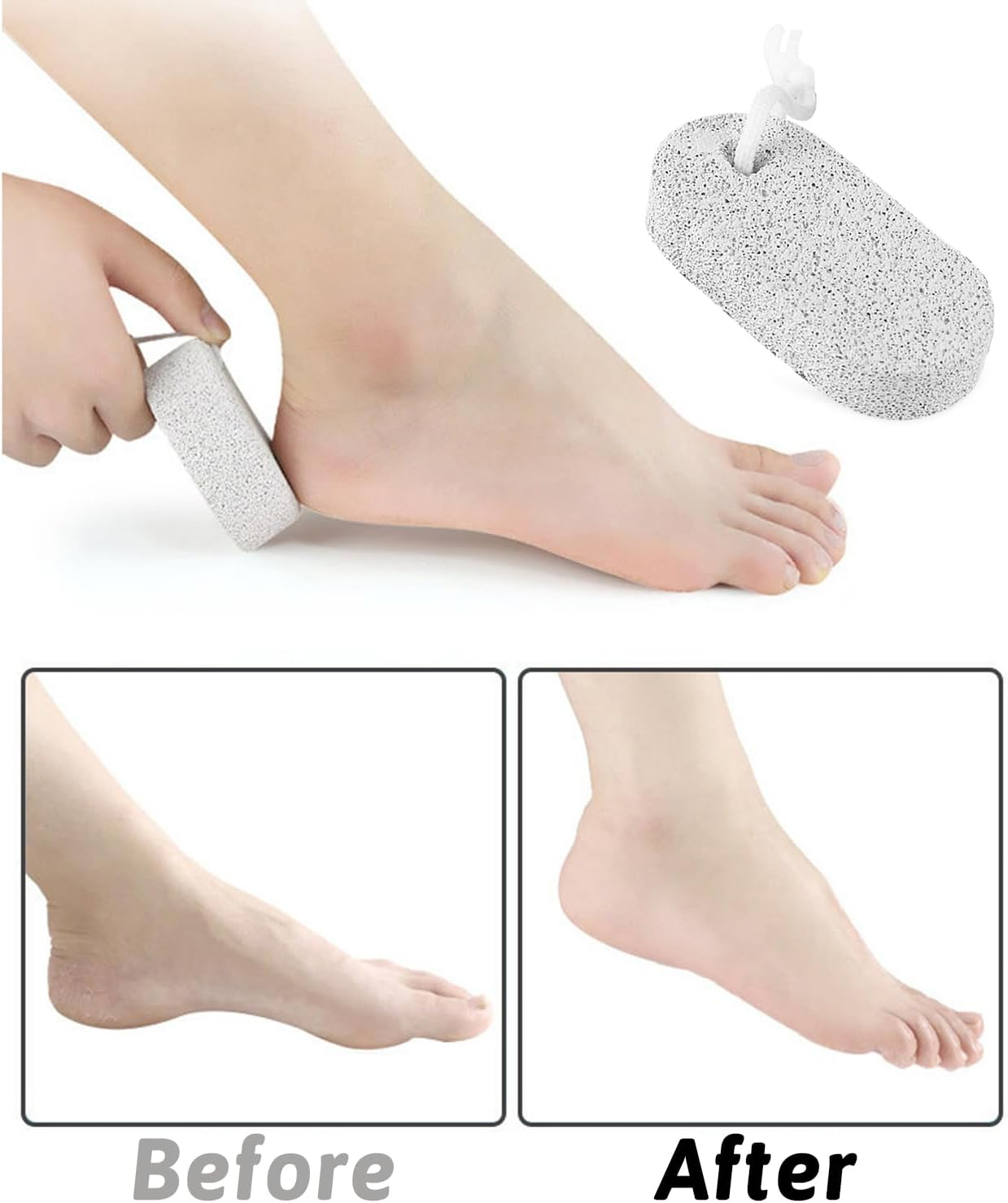 Pumice Stone for Feet/Hands/Body, Natural Lava Pumice Stone for Dead Hard Skin Removal, Foot Scrubber, White Calluse Remover, Foot File for Men/Women for Exfoliation(Oval) image number 2