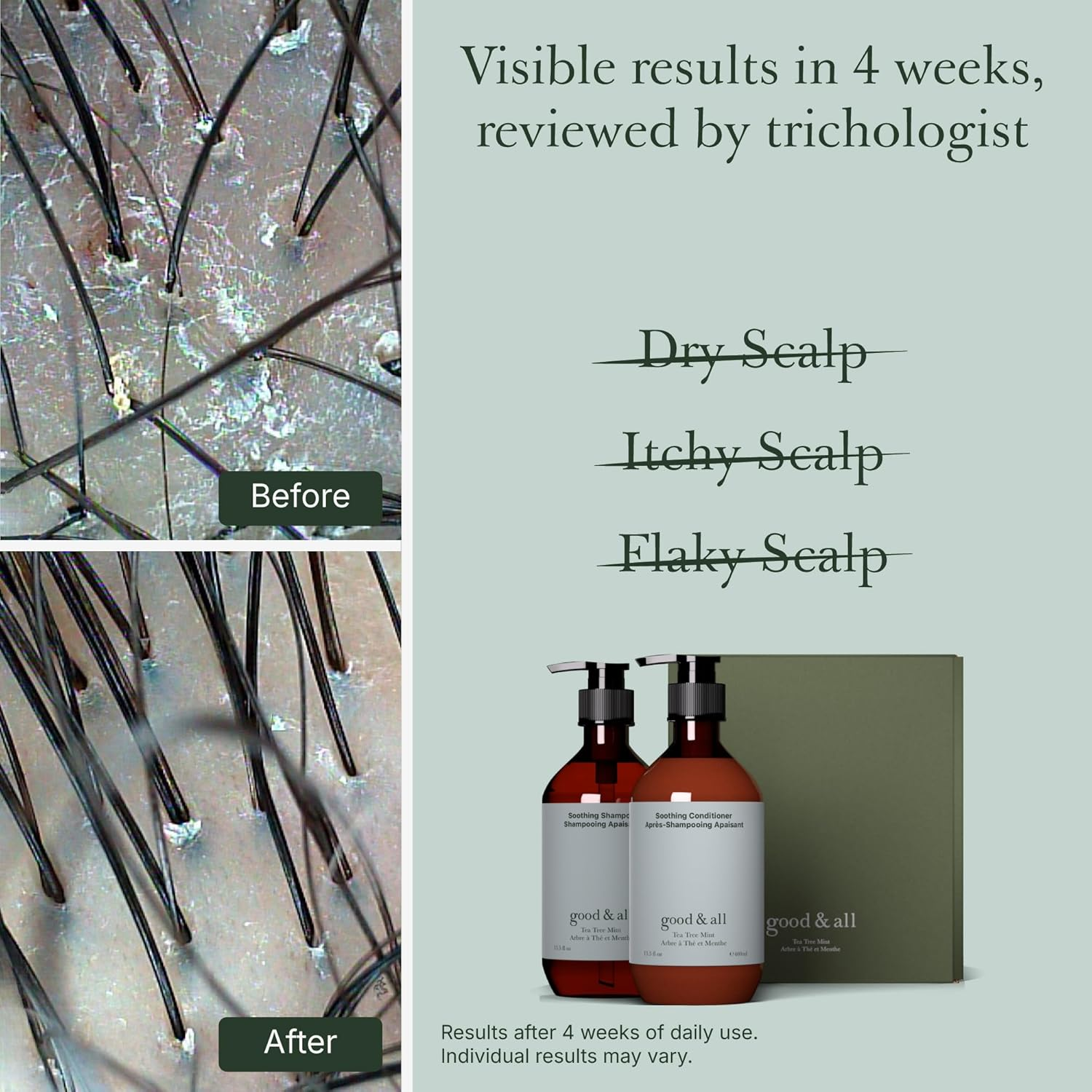 Good&All Tea Tree Shampoo and Conditioner Set for Dry Itchy Scalp with Peppermint - Sodium Lauryl Sulfate/Sulphate, Silicone, Paraben, Fragrance Free - 400Ml image number 4