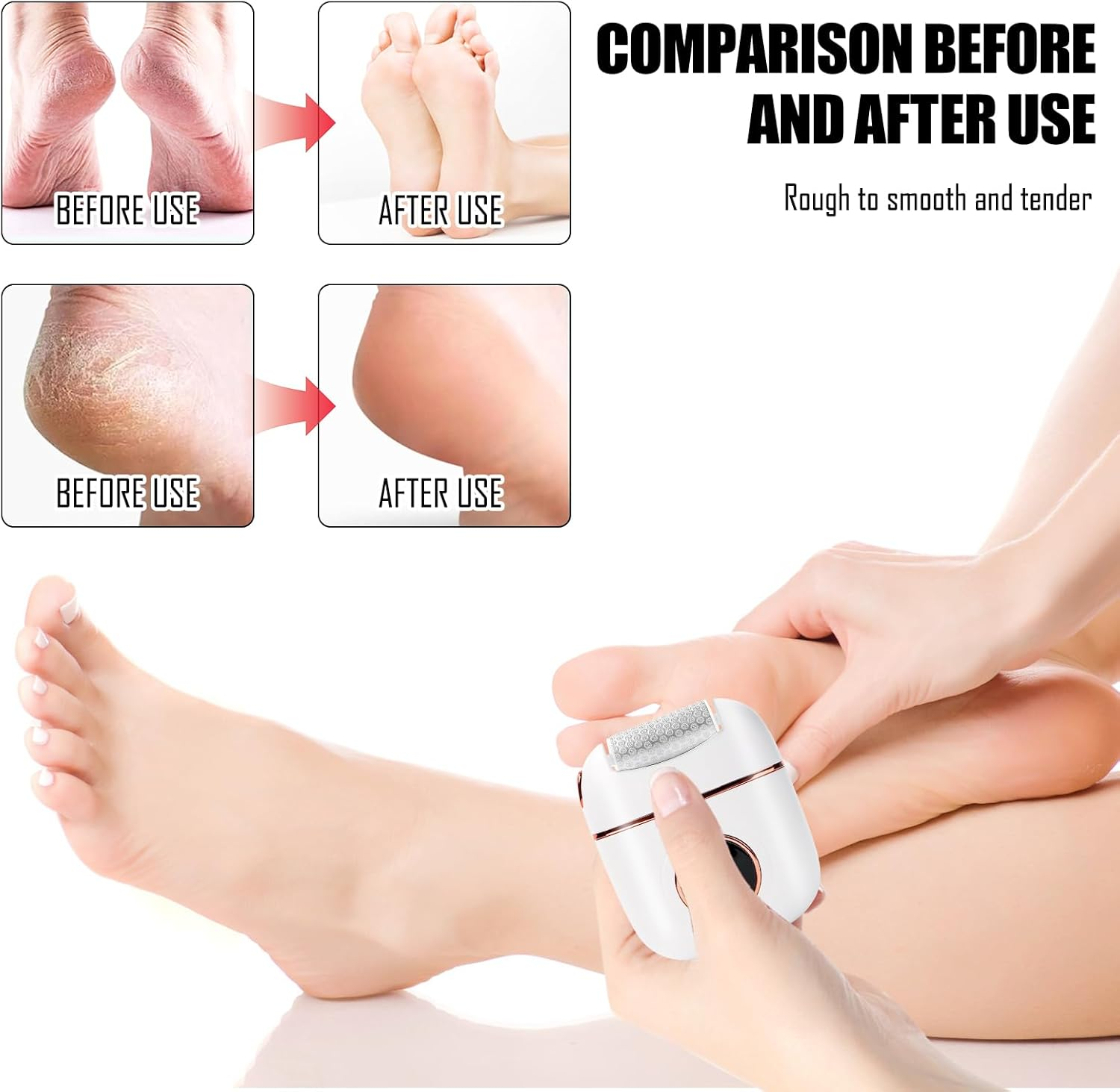 Electric Callus Remover, Electric Foot Sander, Pedicure Set, Foot Care Electric, Strong Foot File Grinder & Heel Grinder with 2 Replacement Rollers for Soles, Toes and Heels