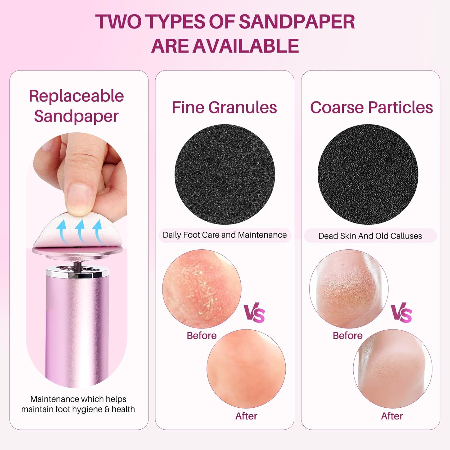 LIONVISON Electric Foot Callus Remover: Adjustable Speed Foot File for Cracked Heels - Working Women'S Summer Pedicure Tool with 60Pcs Sandpaper Discs - Dead Skin Remover for Dry Feet At-Home image number 6