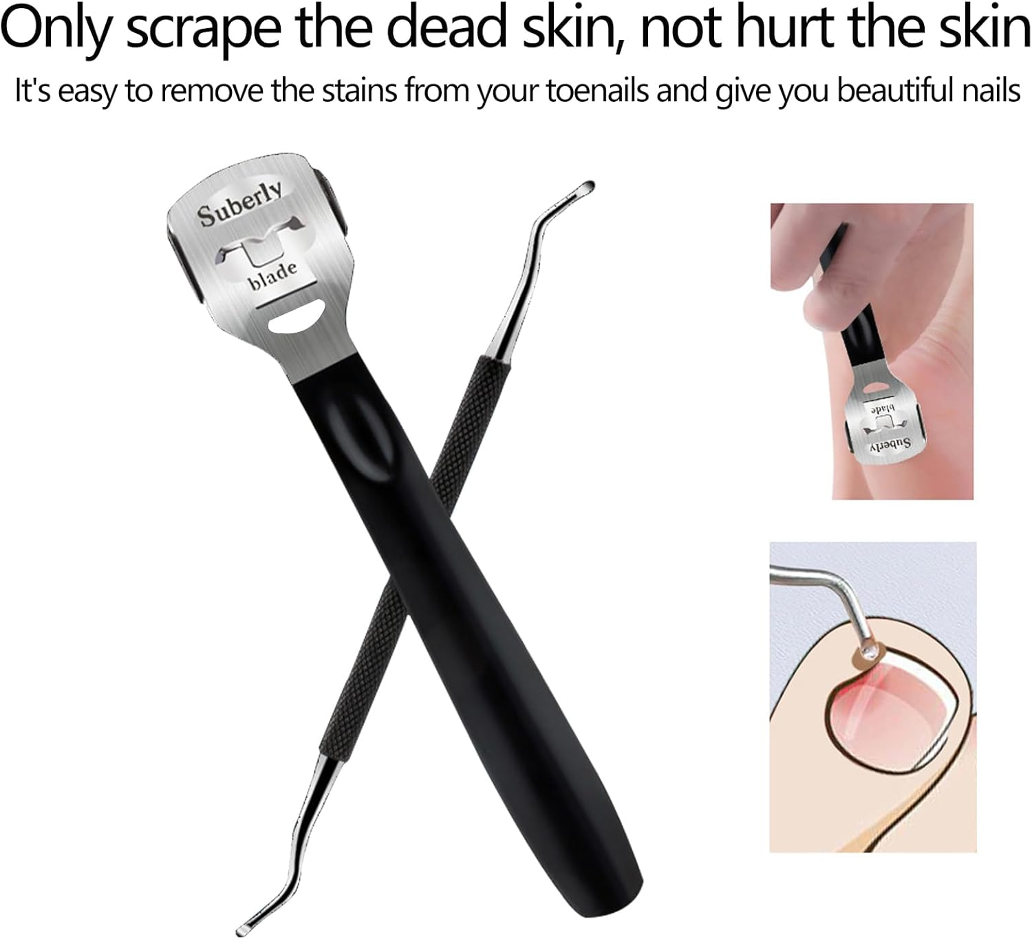 10-Piece Nail Clipper Set-Heavy Duty for Thick/Ingrown Nails,304 Stainless Steel,Ergonomic Handle,Pu Storage Case - Family &Travel Use