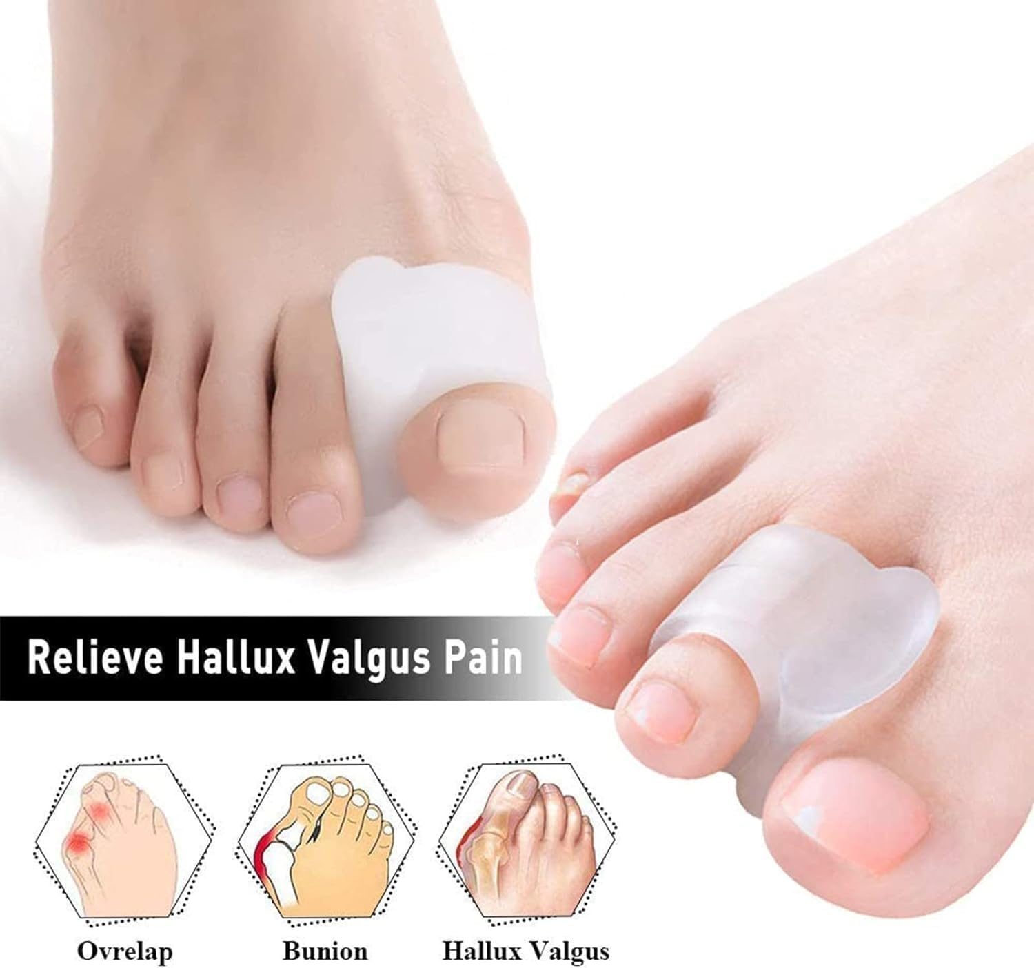 Gel Toe Separators for Overlapping Toes, 4 PCS Bunion Big Toe Straighteners, Thumb Tail Finger Ring Nursing Pad Split Toe Corrector Fixator for Hallux Valgus, Correctior Hammer Toe Relieve Pain (White) image number 1