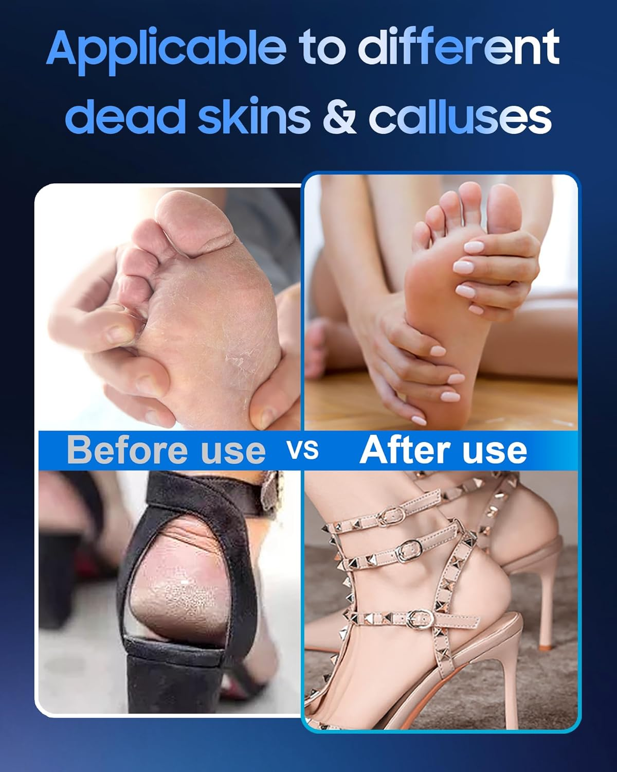 11000 RPM Rechargeable Electric Foot Callus Remover with 2Glass Sander Discs - Cordless Foot Scrubber,Professional Pedicure Tool for Dead Skin and Calluses,Electric Foot File - Blue image number 6