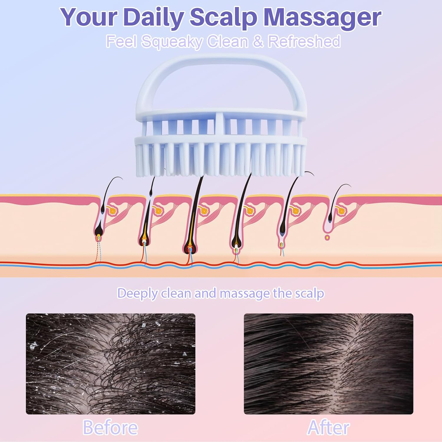 DUAIU Scalp Massage Brush with Hair Oil Applicator, 2 Pieces Silicone Head Massage Brush and 1 Piece Hair Oil Applicator, Massage Brush Hair Applicator Bottle Hair Kit Hair Growth Accelerate - Pink/Blue image number 2