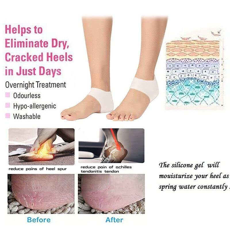 AIMALL 1 Pair Silicone Gel Heel Socks for Cracked Feet and Pain Relief &ndash; Reusable Foot Care Sleeves for Plantar Fasciitis, Heel Spurs, Moisturizing Skin Protector image number 3