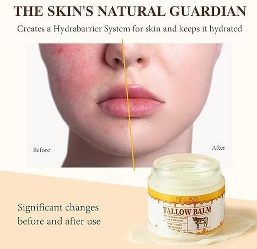 Beef Tallow and Honey Balm for Skin: Premium Tallow Honey Skin Balm (2 Oz) - Grass-Fed Beef Tallow & Raw Wild Honey Blend - All-Natural Moisturizer for Face & Body, Tallow Balm for Skin Hydration (2)